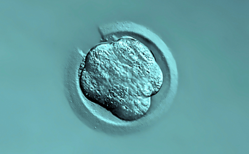 Assisted Hatching | Union Hospital