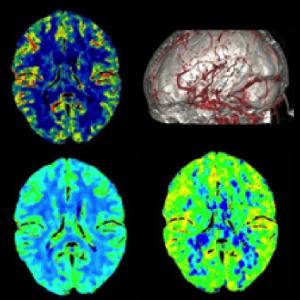 Union Imaging & Healthcheck Centre | Magnetic Resonance Imaging (MRI) | MRI scan