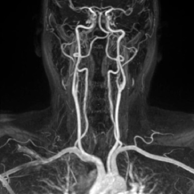 仁安医疗造影体检中心 | 磁力共振扫描 (MRI) | 磁力共振检查