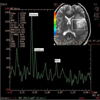 仁安醫療造影體檢中心 | 磁力共振掃描 (MRI) | 磁力共振檢查