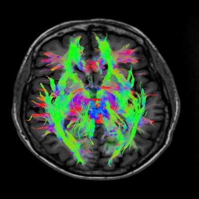 仁安醫療造影體檢中心 | 磁力共振掃描 (MRI) | 磁力共振檢查