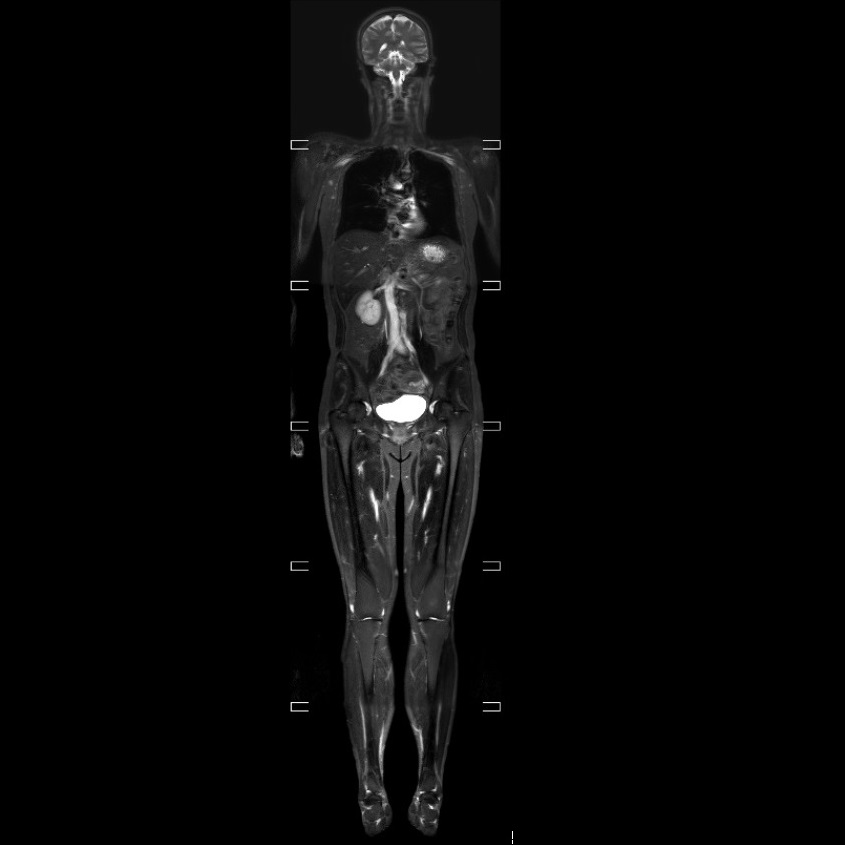 仁安医疗造影体检中心 | 磁力共振扫描 (MRI) | 全身磁力共振扫描