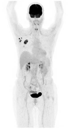 仁安医疗造影体检中心 | 正电子及电脑双融扫描 (PET/CT) | 一般仪器扫描12分钟