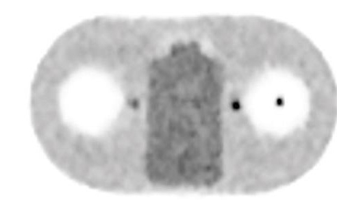 仁安醫療造影體檢中心 | 正電子及電腦雙融掃描 (PET/CT) | 使用Q. Clear的影像