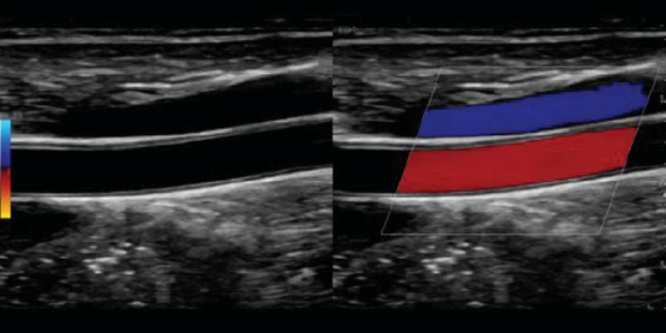 Union Imaging & Healthcheck Centre | Ultrasound (US) | Ultrasound Transducers